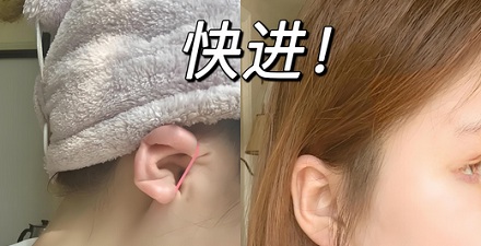 为何明星喜欢在耳朵上绑皮筋?