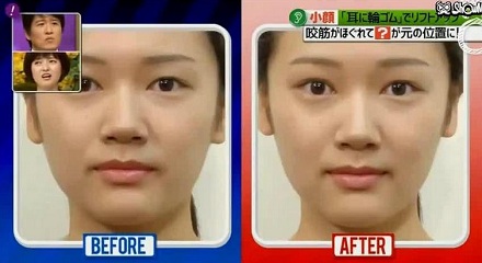 为何明星喜欢在耳朵上绑皮筋?