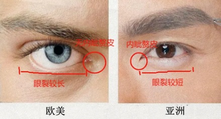 为啥现在欧美人喜欢做「闭眼角手术」?