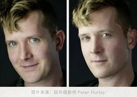 为啥现在欧美人喜欢做「闭眼角手术」?