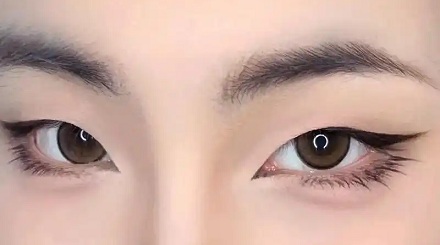 为啥现在欧美人喜欢做「闭眼角手术」?