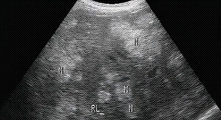 既然有「B 超」，那有「A 超」和「C 超」吗？