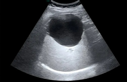 既然有「B 超」，那有「A 超」和「C 超」吗？