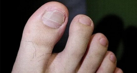 为啥说脚趾长毛可能是好事？