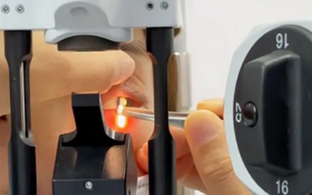 为什么眼上得了这种病，医生会建议你割个双眼皮？