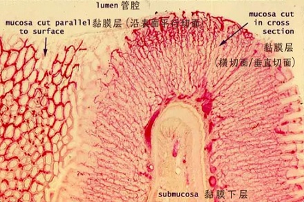 为什么当我们难过时，胃黏膜会变成灰白色？