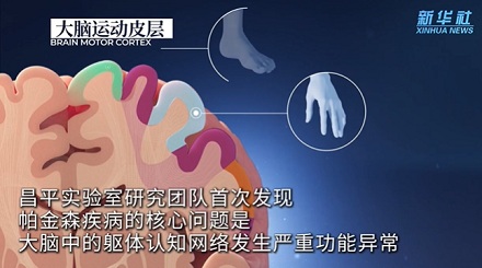 在路上遇到走小碎步的老人，为什么千万不能按喇叭？